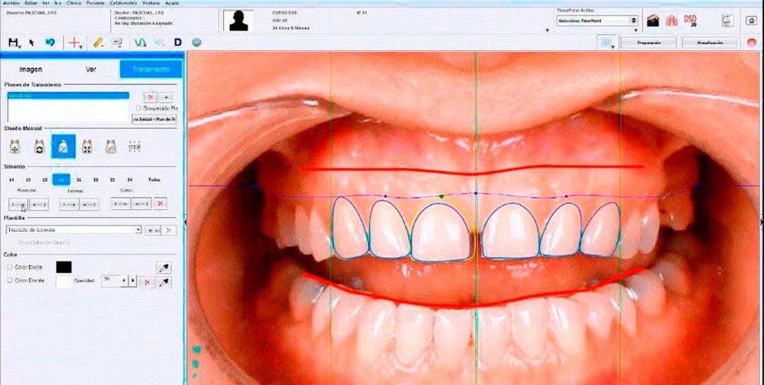 ¿En qué consiste la odontología mínimamente invasiva?
