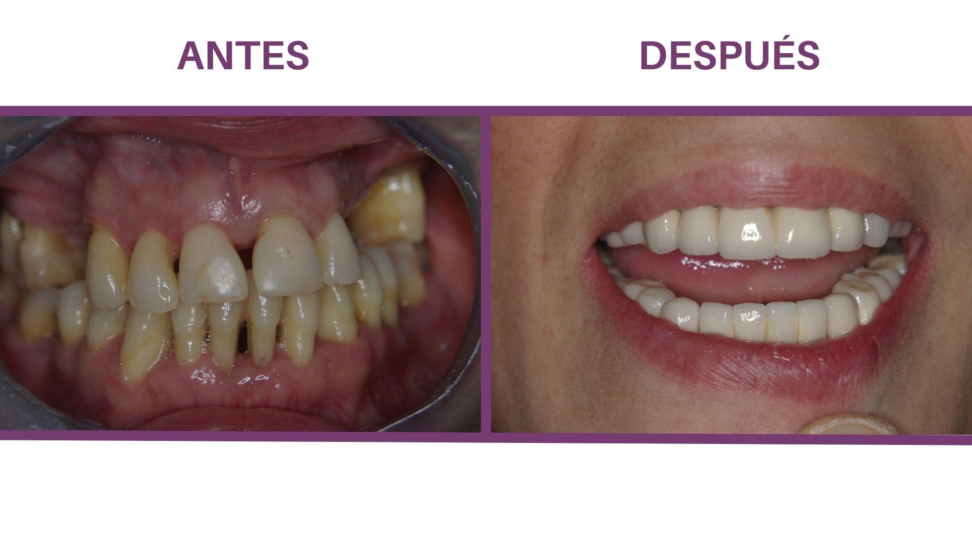 ¿en Qué Consiste La Periodoncia Dental Y Cómo Te Ayuda A Mantener Una Boca Sanaemk 7068