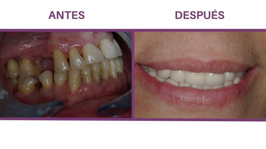 periodoncia dental