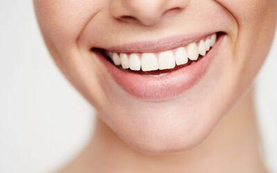 ¿En qué consiste la estética dental y cómo puede mejorar tu sonrisa?