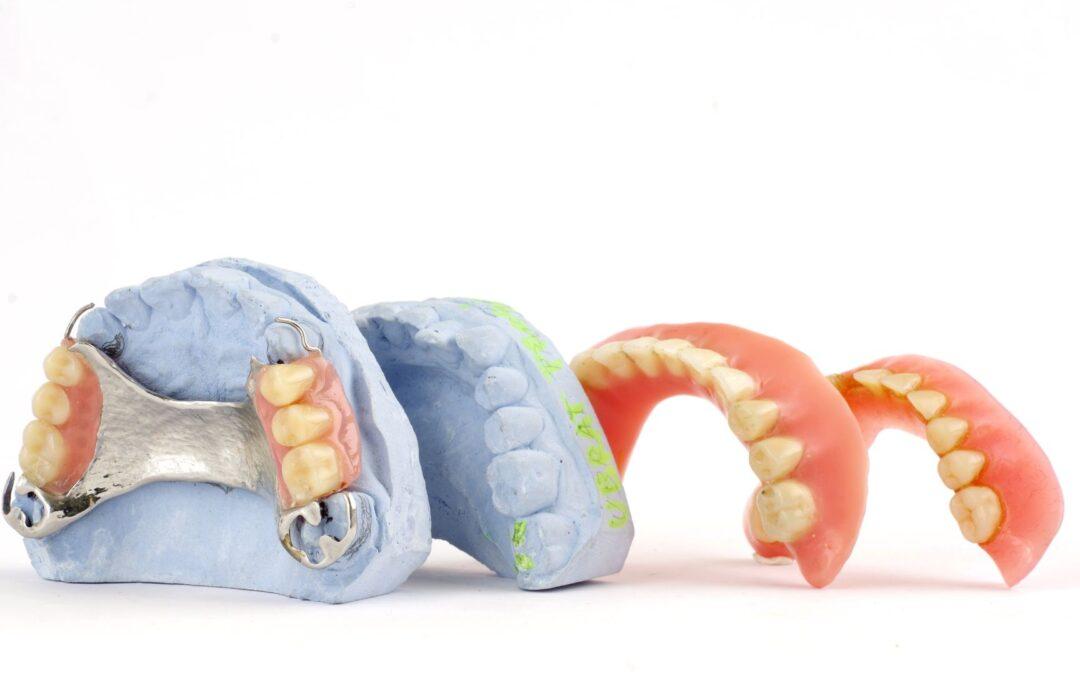 Cómo limpiar prótesis dentales de forma efectiva y segura