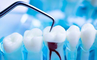 ¿Qué es y para qué sirven las endodoncias?
